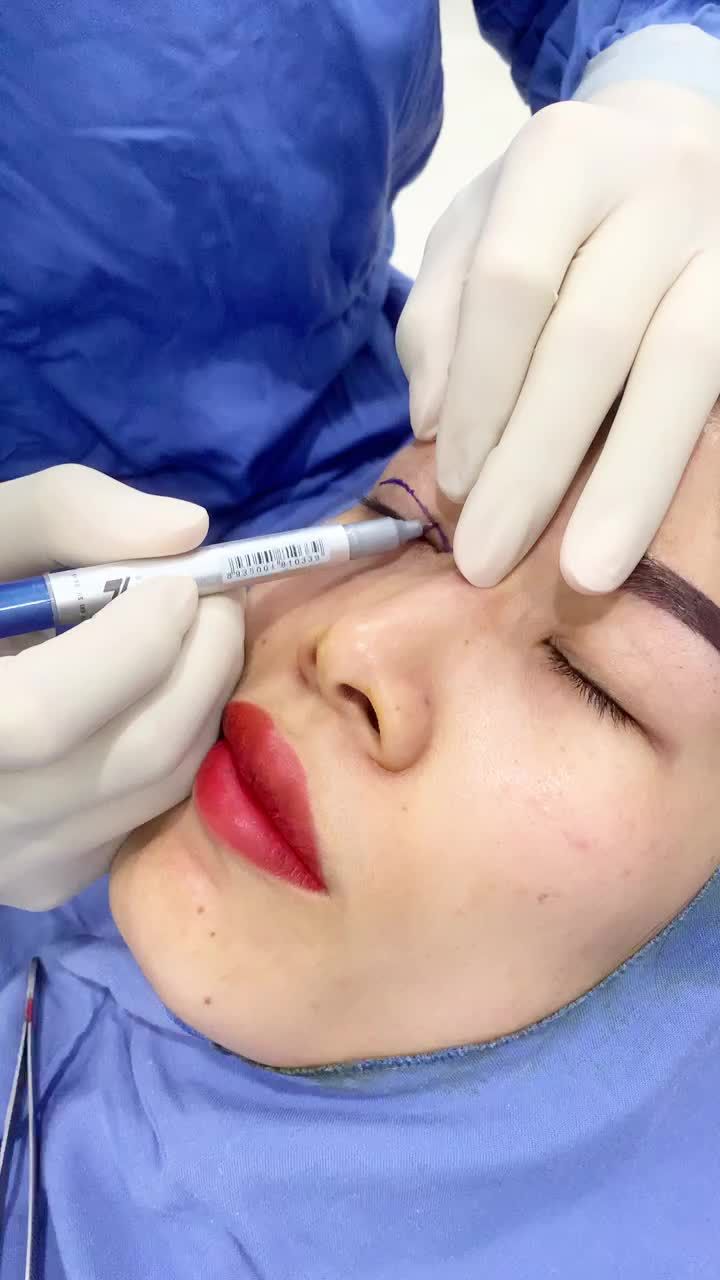 Cắt mí ở Kangnam, lo gì không đẹp kịp Tết
