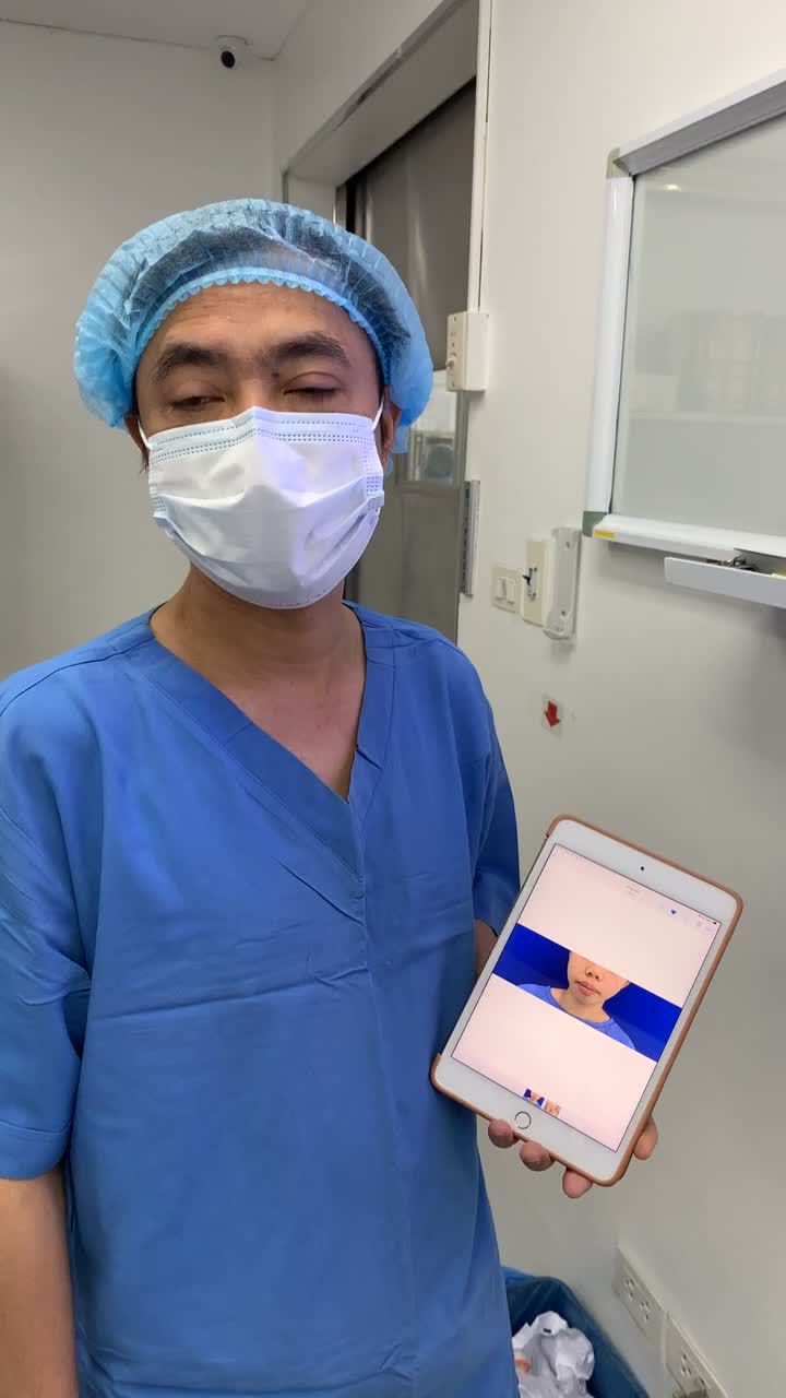 Tạm biệt gương mặt hô sau phẫu thuật chỉnh 2 hàm + trượt cằm tại Bệnh viện thẩm mỹ Kangnam Hà Nội 190 Trường Chinh