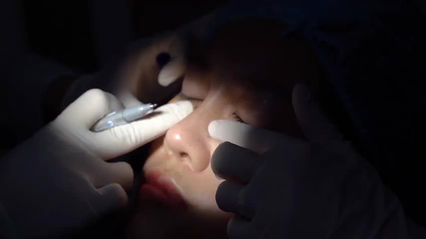 Filler mũi có thực sự an toàn như bạn nghĩ Theo dõi video ngay sau đây