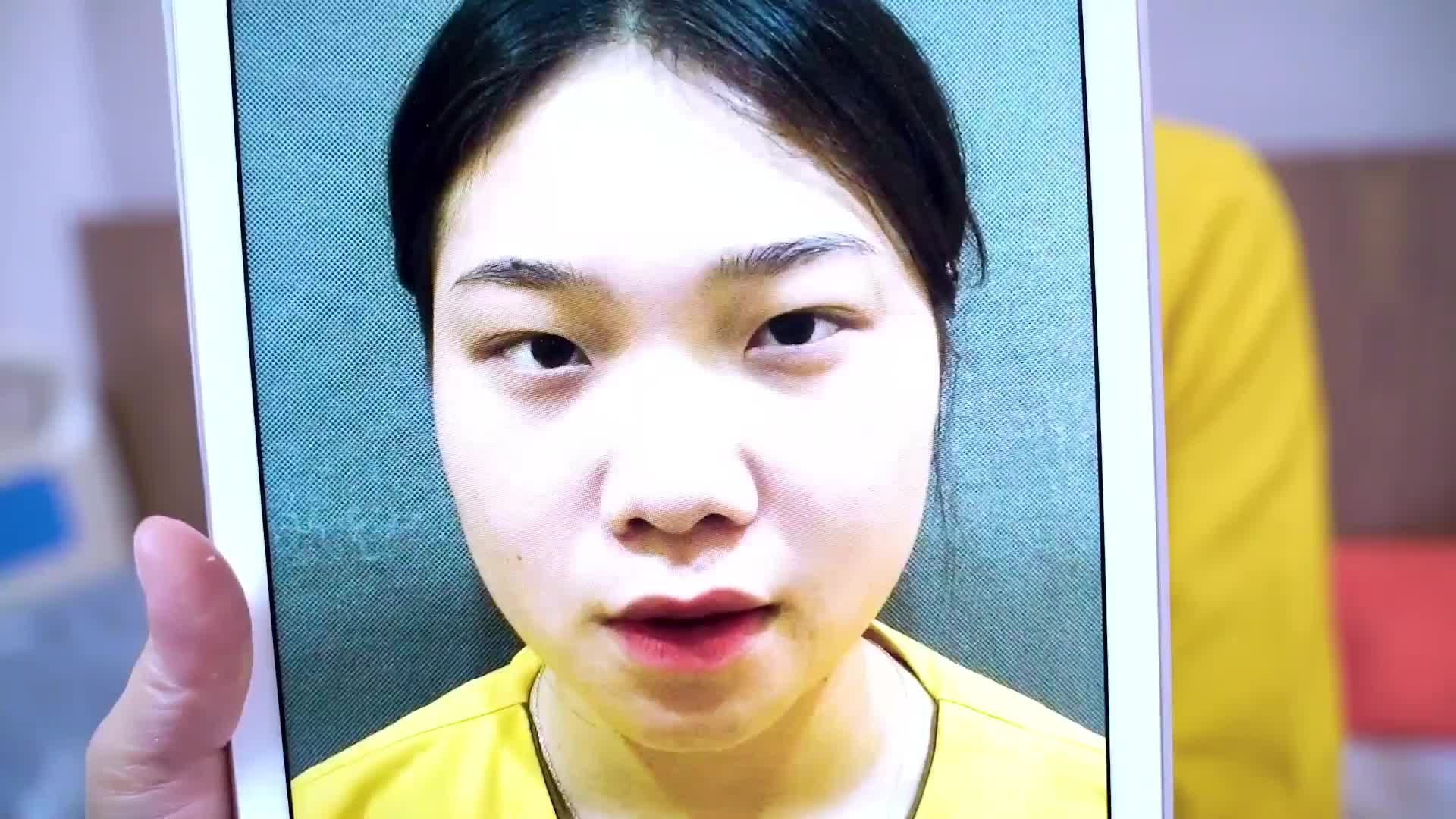 Đây là lý do tại sao Dr.Hải Lê là địa chỉ cắt mí số 1 hiện nay Mời cả nhà cùng chiêm ngưỡng!
