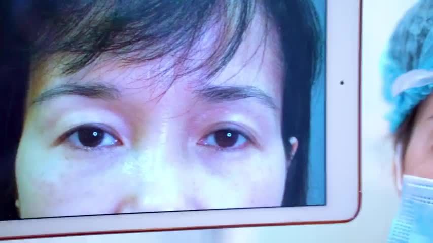 Biết cắt mí xong đẹp như thế này tôi đã làm sớm hơn