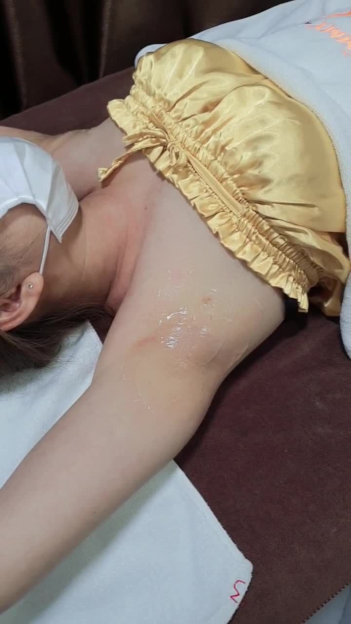 Triệt lông nách bằng công nghệ diode laser tại bệnh viện thẩm mỹ Kangnam