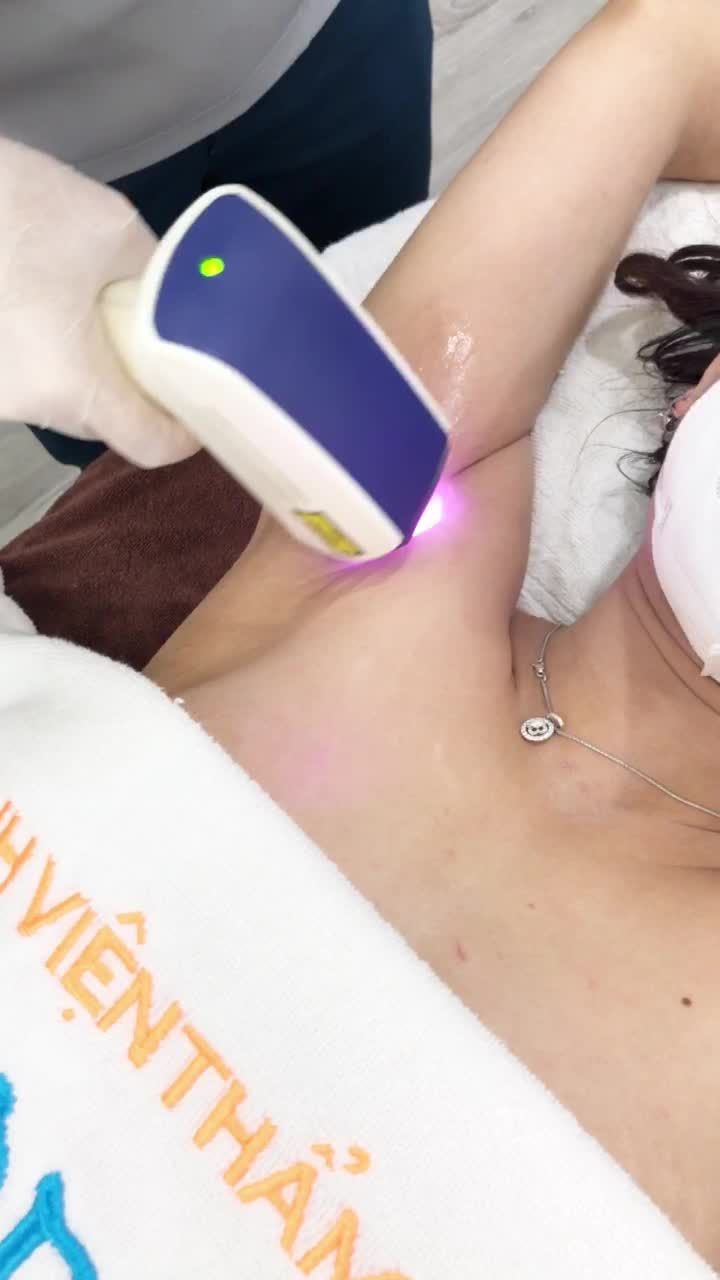 Lông nách cạo nhổ nhiều năm, gốc lông cứng, mọc nhiều chân