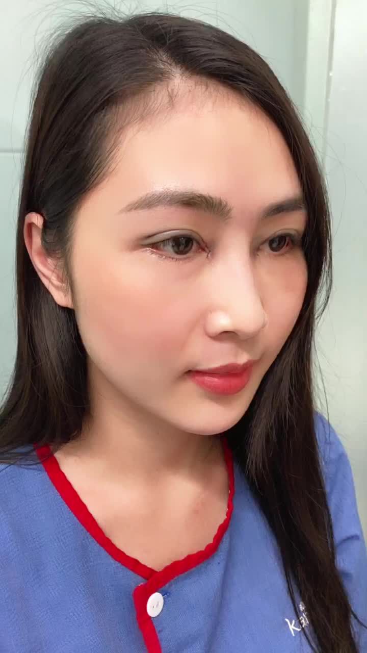 Combo thần thánh BẤM MÍ + TẠO KHÓE cho đôi mắt bồ câu đẹp hút ánh nhìn