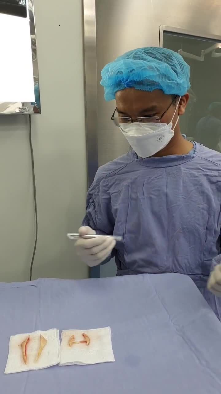 Nữ khách hàng Việt Kiều về quê ăn Tết  Sắm ngay chiếc cằm V-line