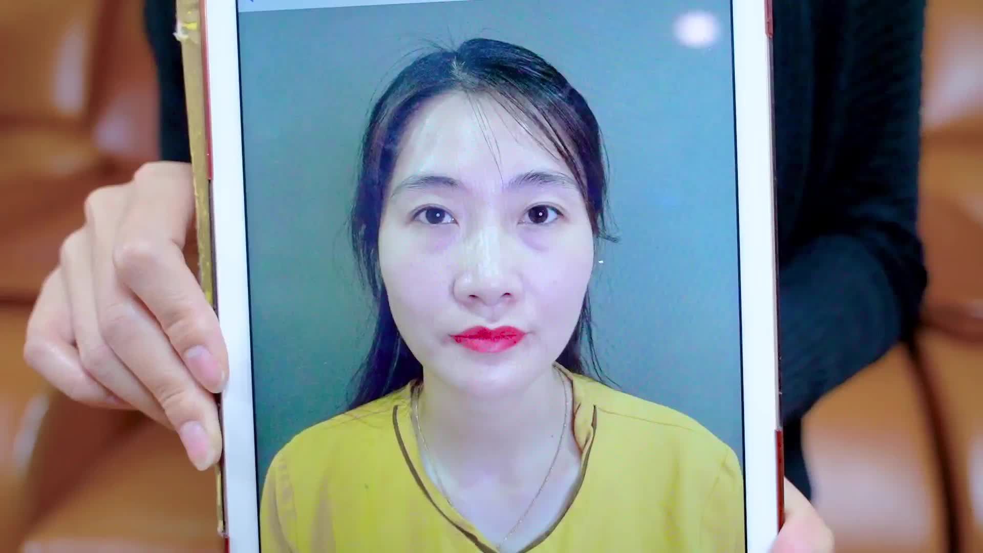 Sau CẮT MÍ Làm sao để MÍ NHANH ĐẸP