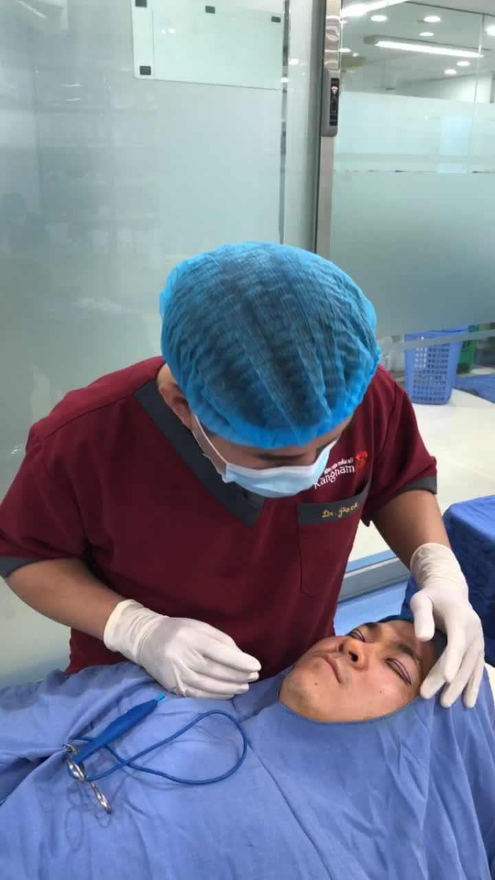Quá trình đo vẽ cắt mí trên Plasma tại Bệnh viện Thẩm mỹ Kangnam Hà Nội