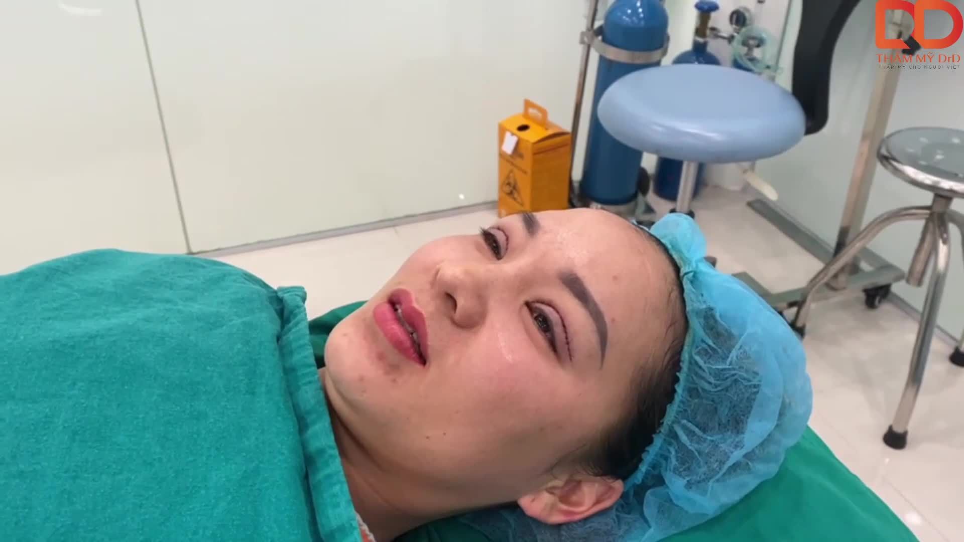 Chị khách hàng đi từ xa đến Thẩm mỹ DrD để thực hiện cắt mí Plus.