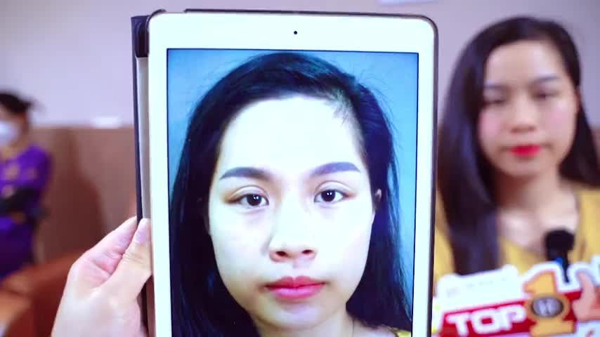 Dr.Hải Lê số 1 phẫu thuật sửa mí lỗi hỏng thành công Theo dõi video ngay sau đây
