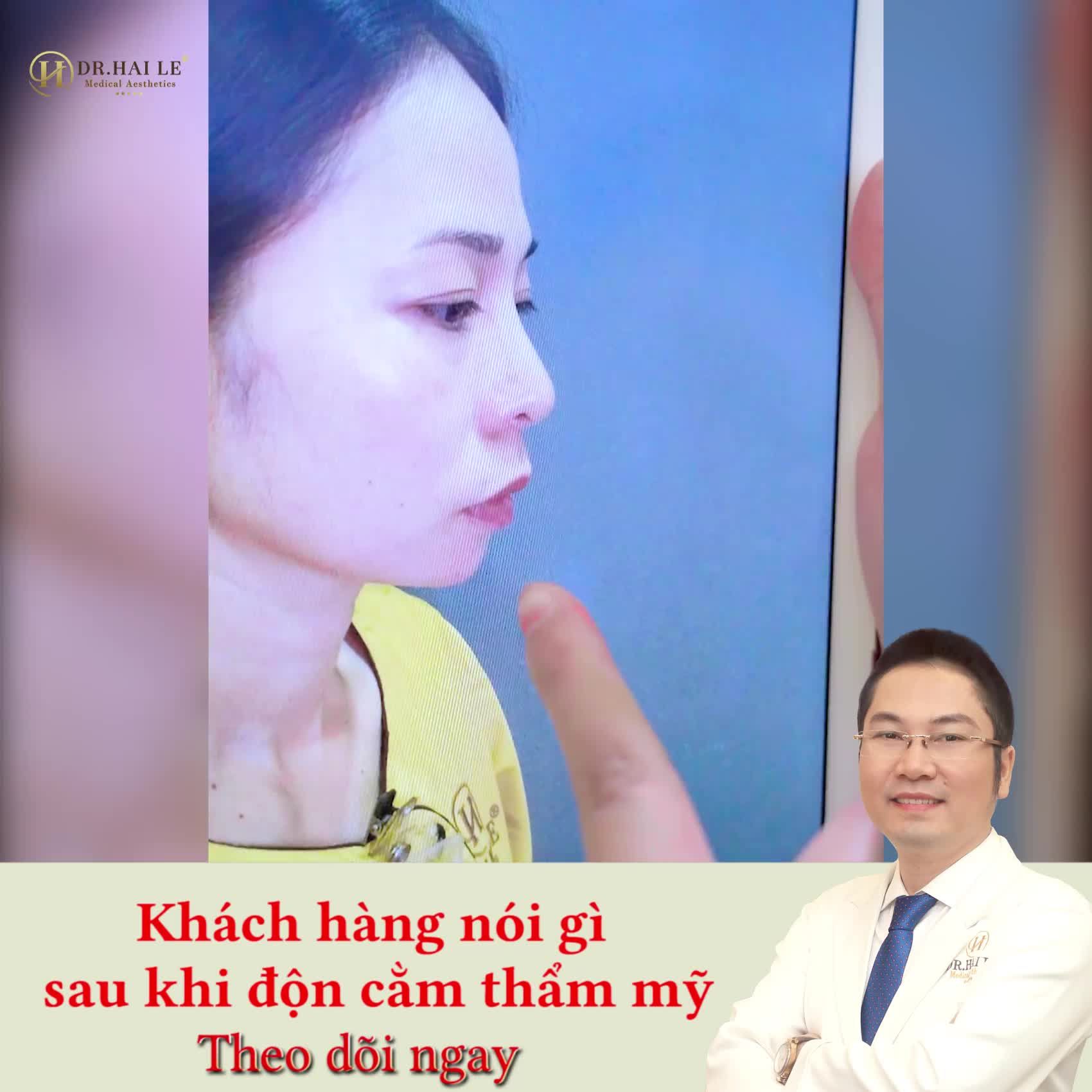 “MUỘN CÒN HƠN BỎ LỠ” - U40 ĐỘN CẰM ĐỂ ĐẸP TẠI SAO KHÔNG