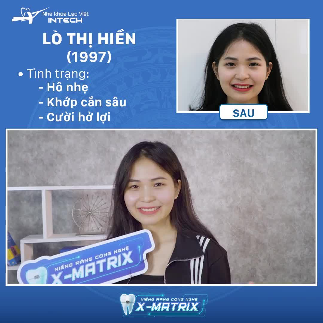 NIỀNG RĂNG HÔ RĂNG ĐẸP CƯỜI XINH, TỰ TIN GIAO TIẾP