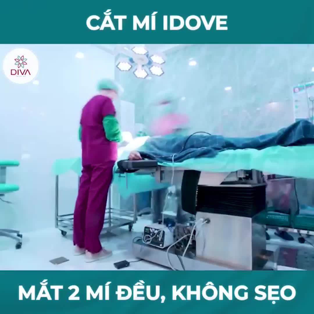 CẮT MÍ MẮT IDOVE TRẢI NGHIỆM 1 LẦN, MÊ MẨN CẢ ĐỜI !