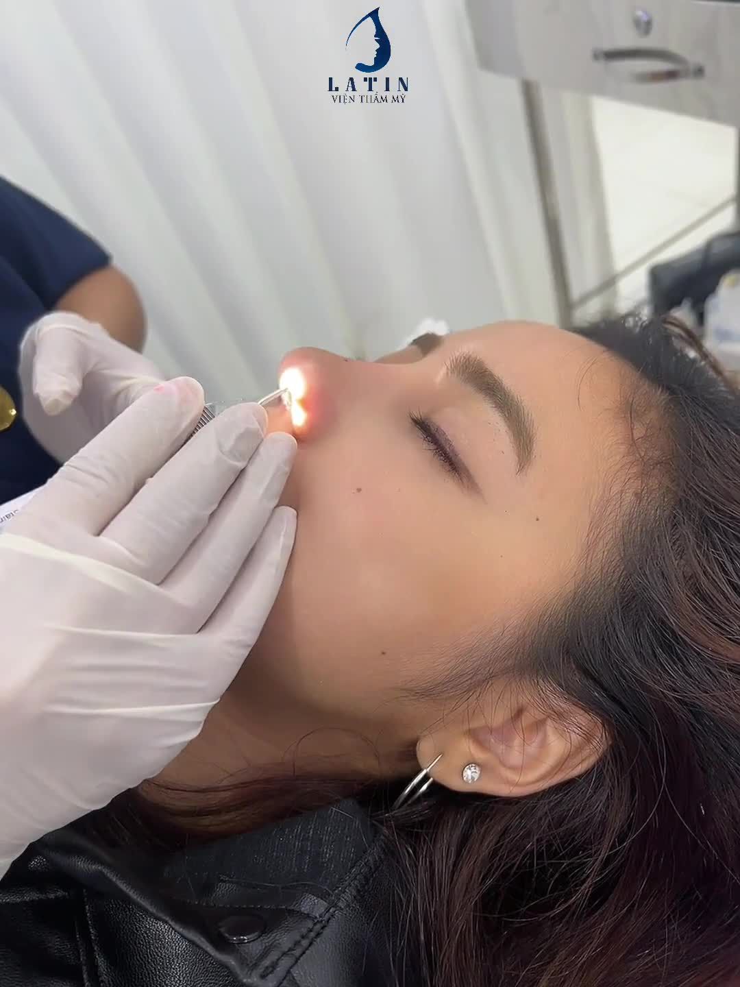 combo mũi cằm xứng đáng có 10 người yêu