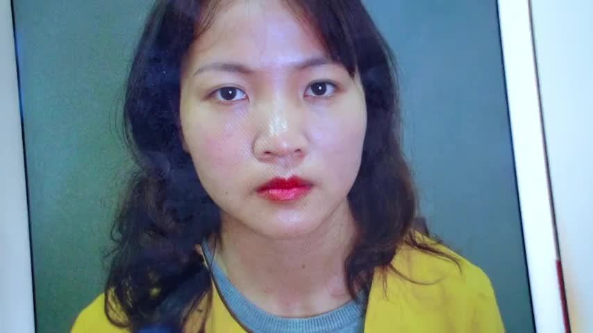 Dr.Hải Lê Nói dỗi khách hàng - Bác sĩ bảo chỉ đẹp tương đối thôi nhưng nhận kết quả lại đẹp hoàn hảo thế này rất chi là hài lòng