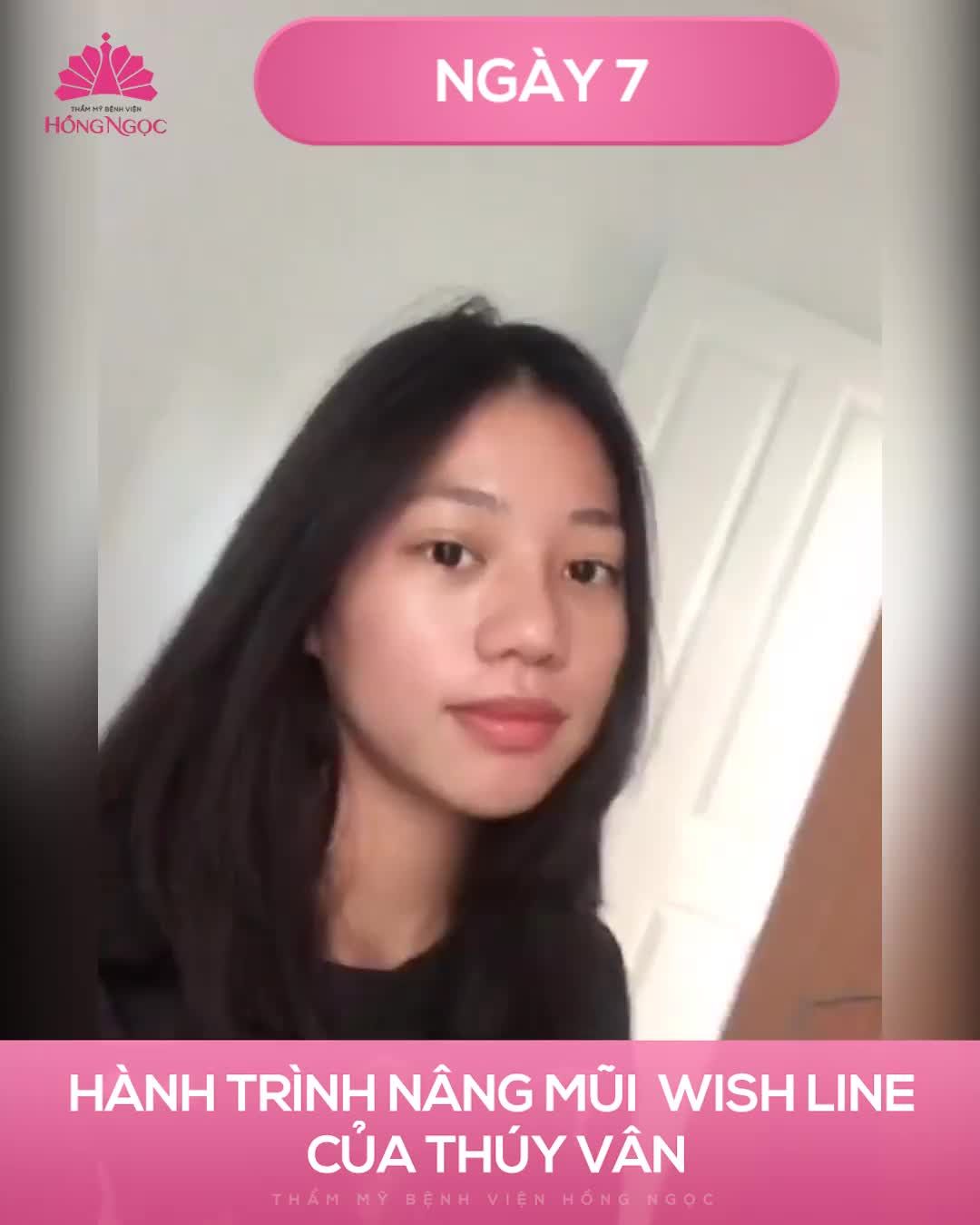 NHẬT KÝ NÂNG MŨI CAO TÂY CỦA NHƯ QUỲNH