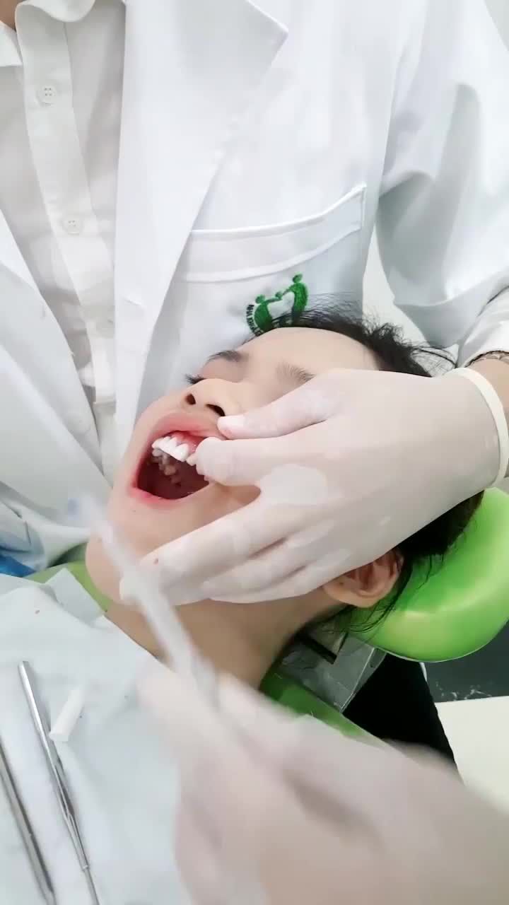 QUÁ TRÌNH DÁN SỨ VENEER CAO CẤP CHO MỘT VỊ KHÁCH HÀNG NỮ
