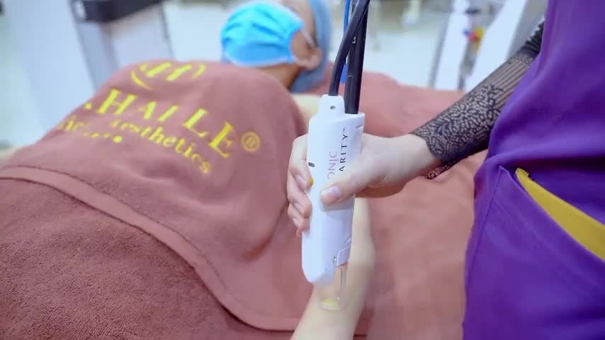 Hè đến chị em lại rần rần chăm sóc da, triệt lông, trị mụn, trị nám.... Cùng theo dõi ca triệt lông vùng cánh tay hiệu quả như thế nào