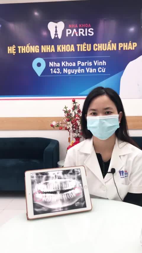 chia sẻ về dịch vụ nhổ R8 (răng khôn) ở nha khoa PARIS chi nhánh Nghệ An