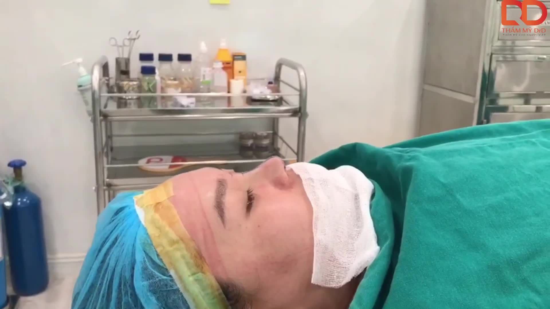 Khách hàng có sống mũi thấp, đầu mũi hếch, ngắn, to, nhìn khá thô.
