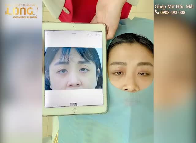 LÀM ĐẸP PHẢI ĐẾN CHỖ NÀO - CHẦN CHỪ GÌ NỮA GHÉ VÀO BSLONG