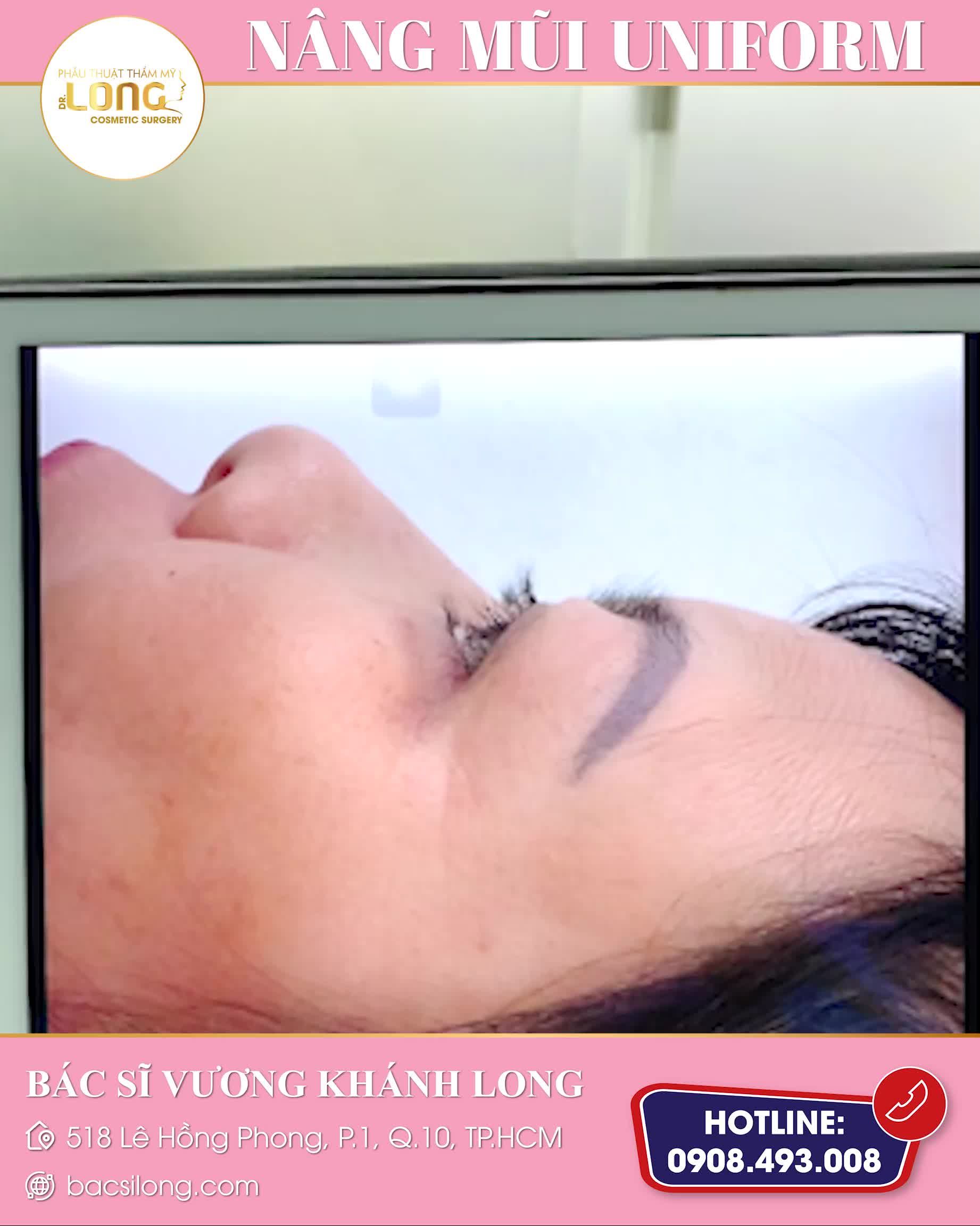DÁNG MŨI CHẤT LƯỢNG ĐẾN TỪ KHÁCH HÀNG NHÀ MÌNH
