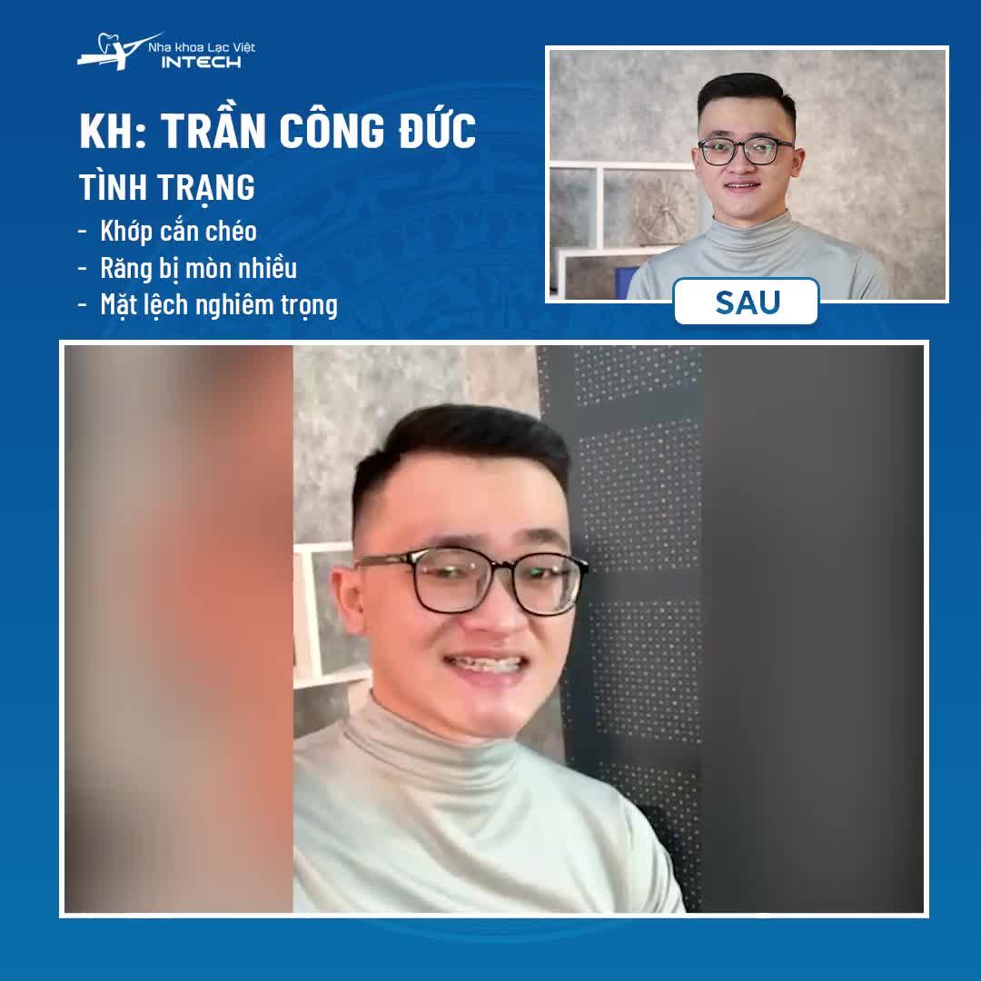 ...NIỀNG RĂNG LÀ QUYẾT ĐỊNH ĐÚNG ĐẮN NHẤT CUỘC ĐỜI ...