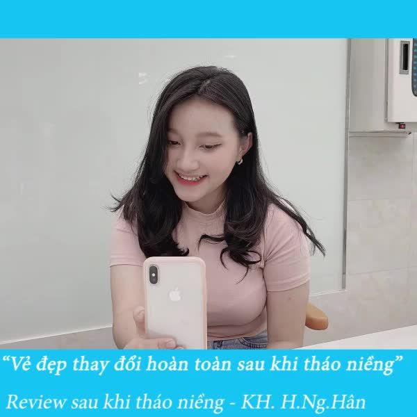 Động lực niềng răng cho các bạn đây nha