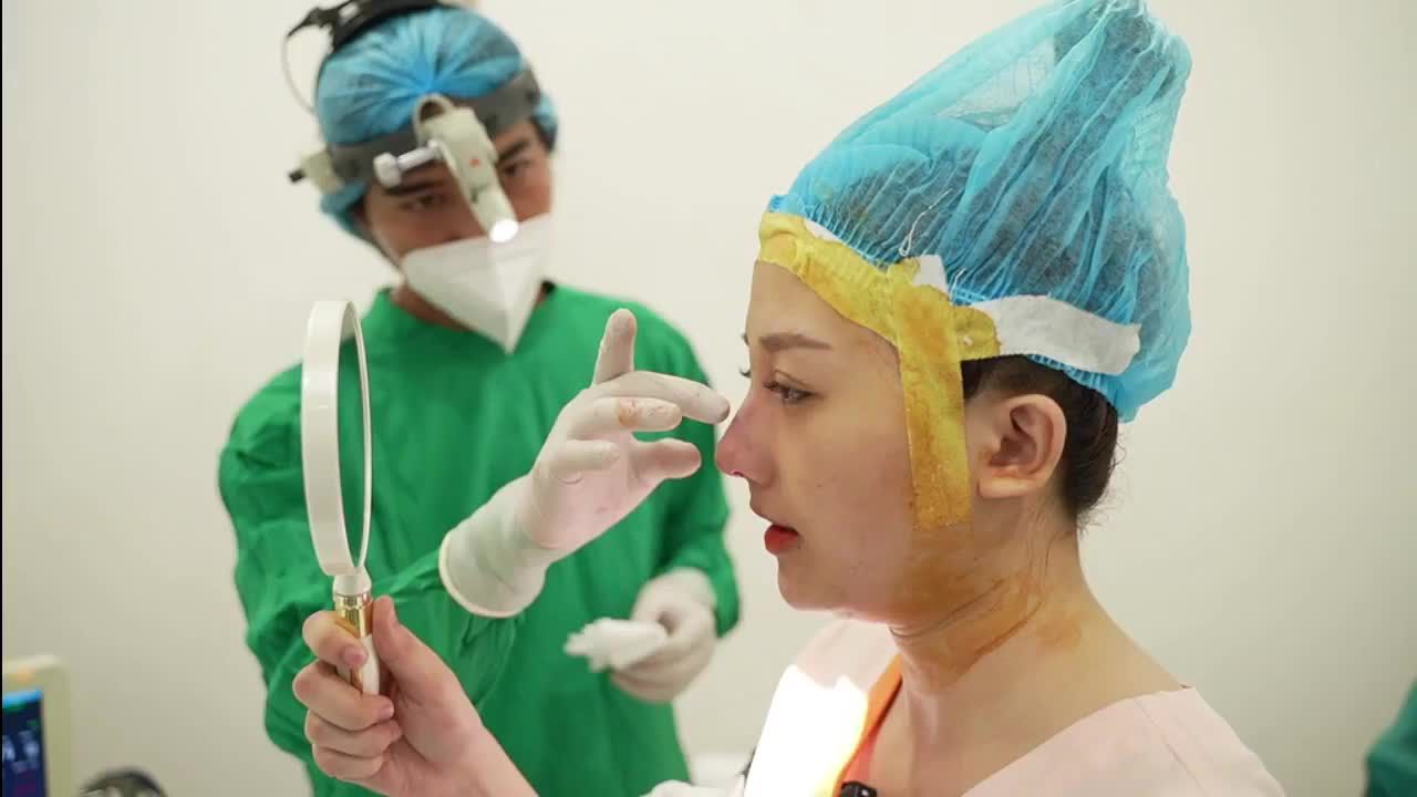 Em thấy gương mặt thay đổi 100% luôn ạ!
