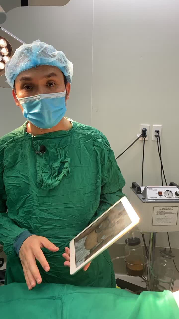 Kết quả Nâng vòng 1 teo lép bẩm sinh - Căng tròn, chuẩn dáng, đẹp hoàn hảo.