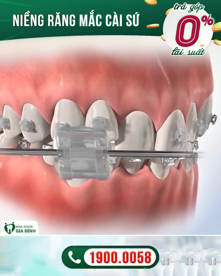 THANH XUÂN NỢ BẠN MỘT NỤ CƯỜI ĐẸP