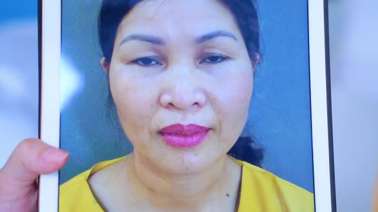 Dr.Hải Lê số 1 thẩm mỹ mắt có giải pháp khắc phục mọi tình trạng mí sụp tuổi trung niên hiệu quả toàn diện