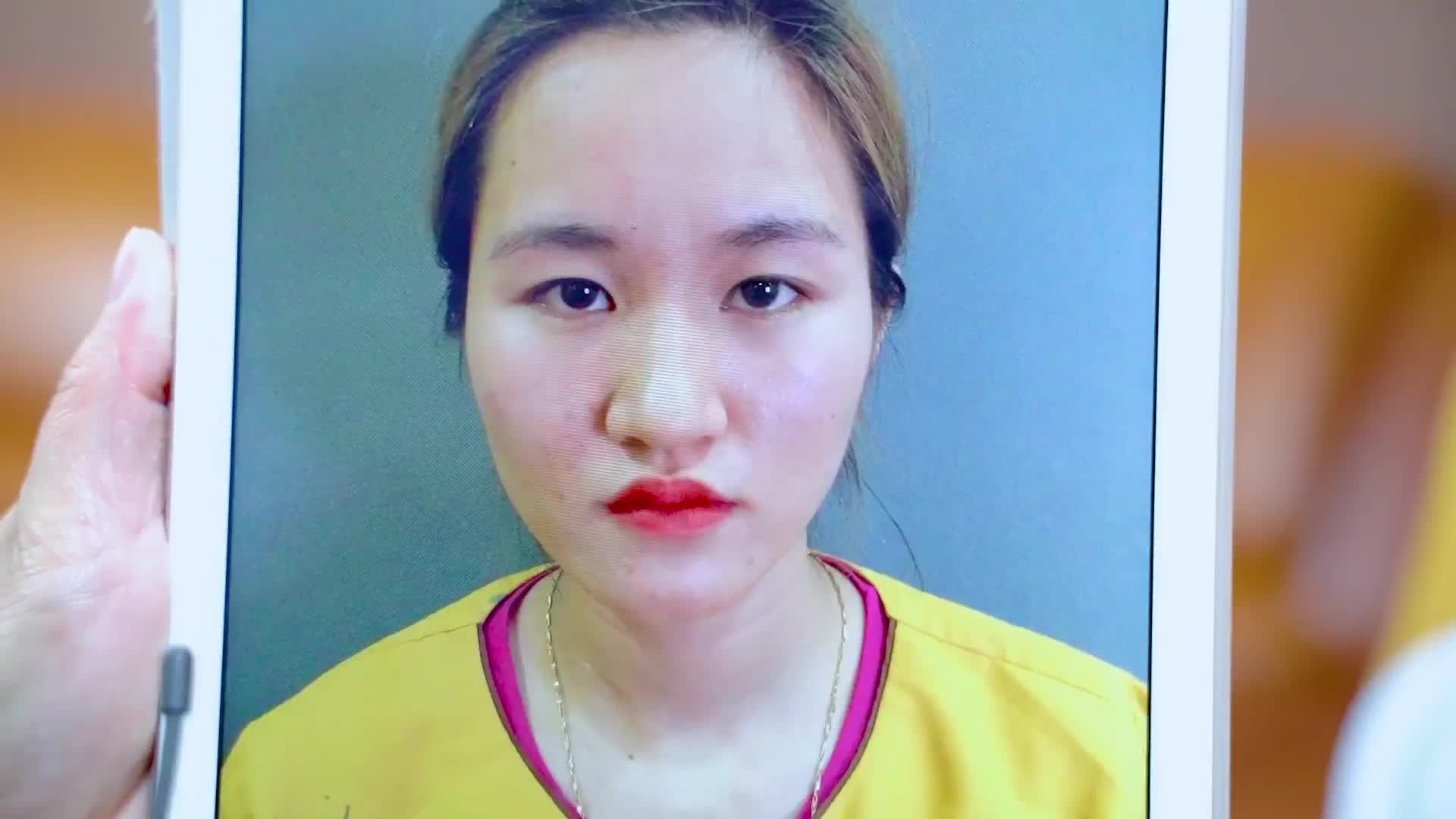 Chiêm ngưỡng ngay tác phẩm sau khi sửa mí  chị khách hàng dưới đây để cùng thấy được sự thay đổi của khách hàng.