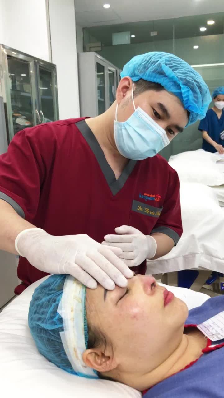 Quy trình nẹp mũi chuẩn Kangnam - không cần đeo dẫn lưu, không căng tức vùng mũi