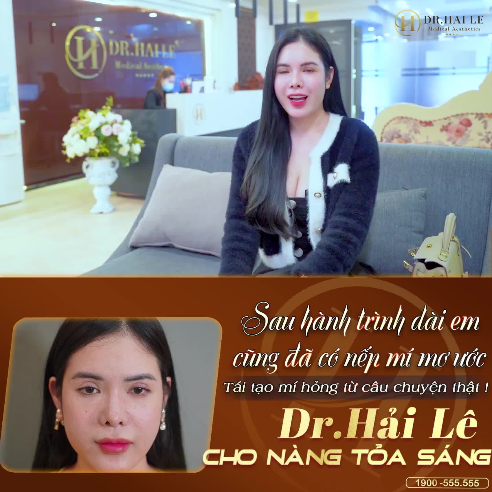 Sau 10 ngày SỬA MÍ, sẽ như thế nào