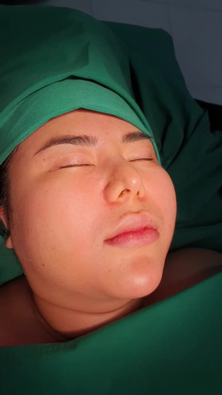 KỸ THUẬT LẤY TÚI MỠ MÁ, TẠO GƯƠNG MẶT THON GỌN - KHÔNG ĐỂ LẠI SẸO