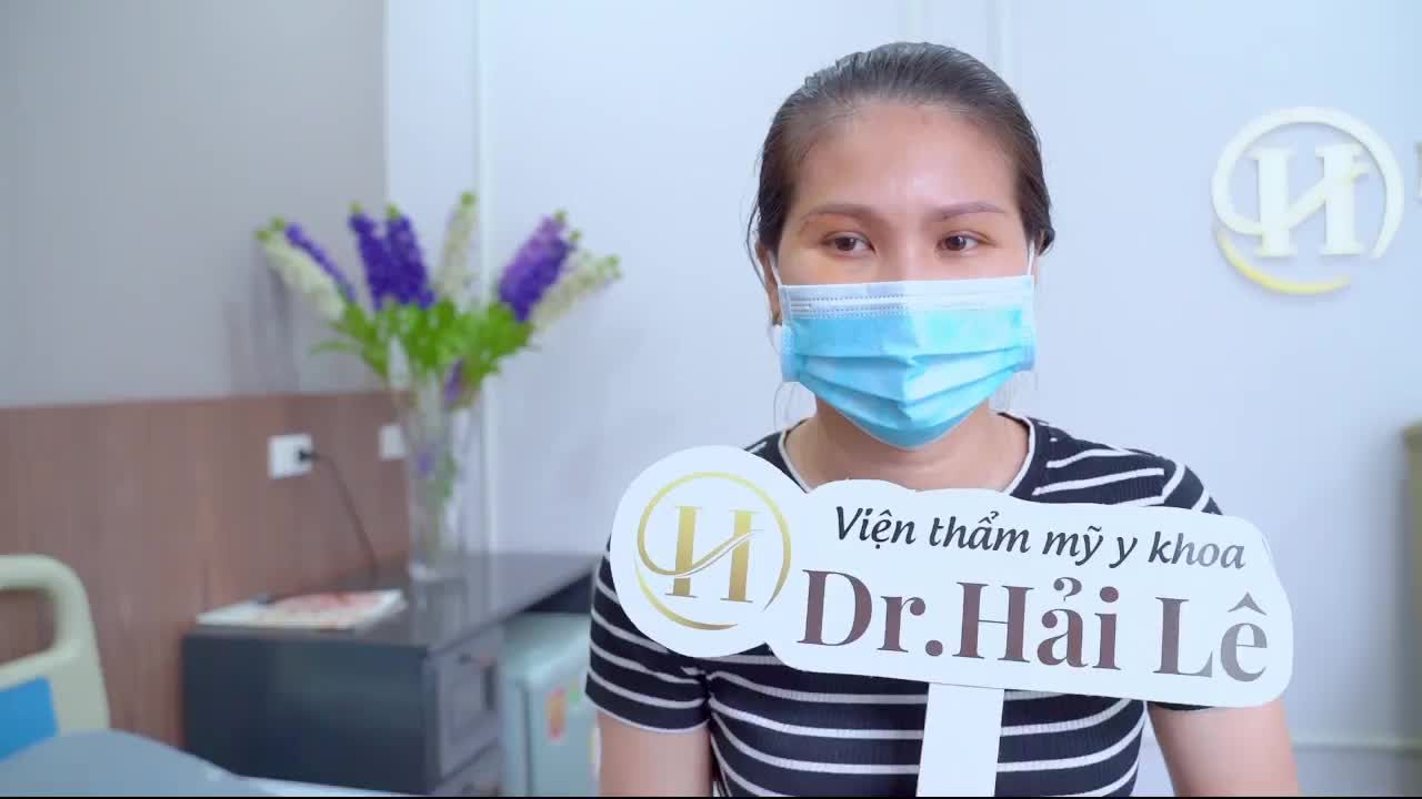 Chiêm ngưỡng ngay kết quả sau khi nâng cung mày sau 7 ngày cắt chỉ thấy được sự thây đổi của khách hàng