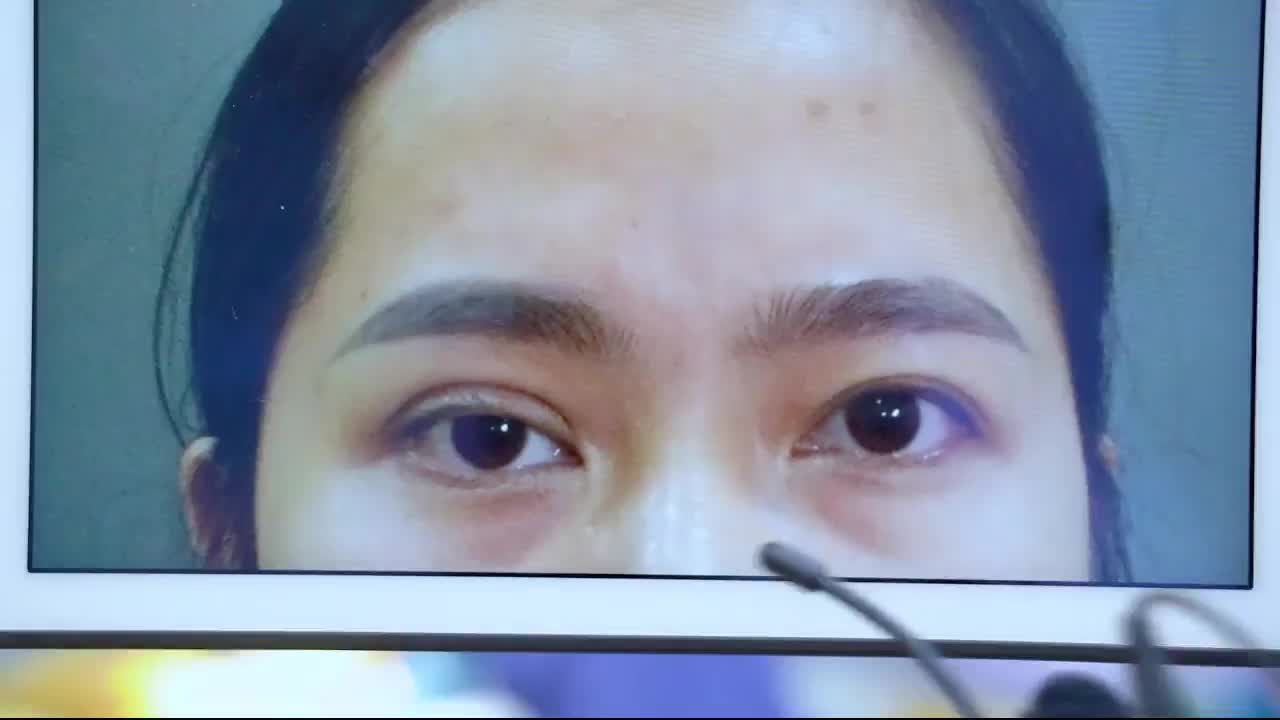 Sự thay đổi và khắc phục được tình trạng mí hỏng lỗi của khách hàng vừa thực hiện xong.