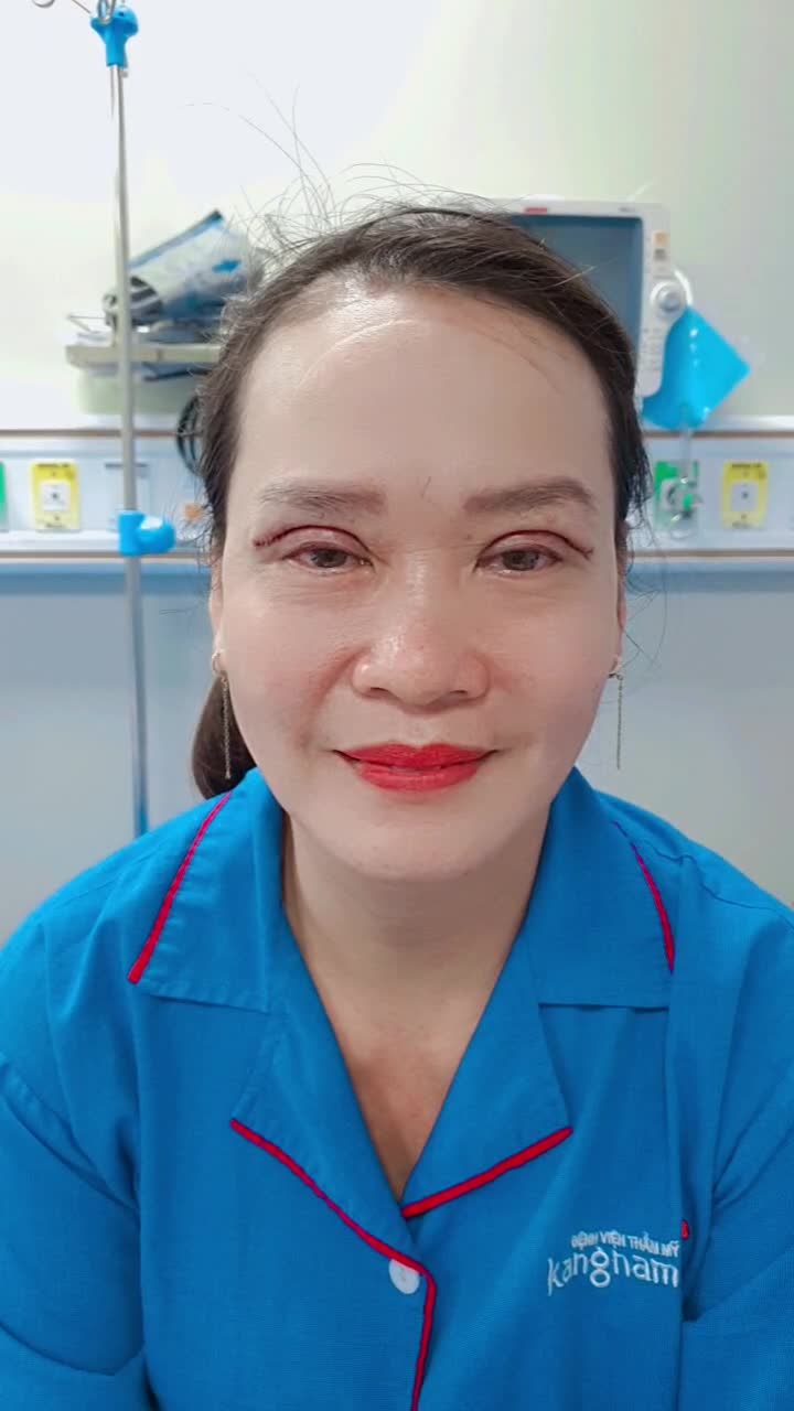 Khách hàng trẻ ra 10 tuổi khi thực hiện dịch vụ cắt mí trên plasma