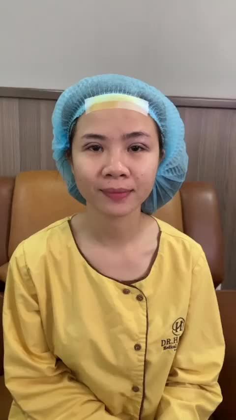 Tại sao Dr.Hải Lê là địa chỉ cắt mí số 1 Theo dõi ngay video sau đây!