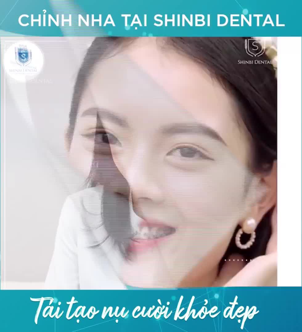 Chỉnh nha tại Shinbi - Tái tạo nụ cười duyên