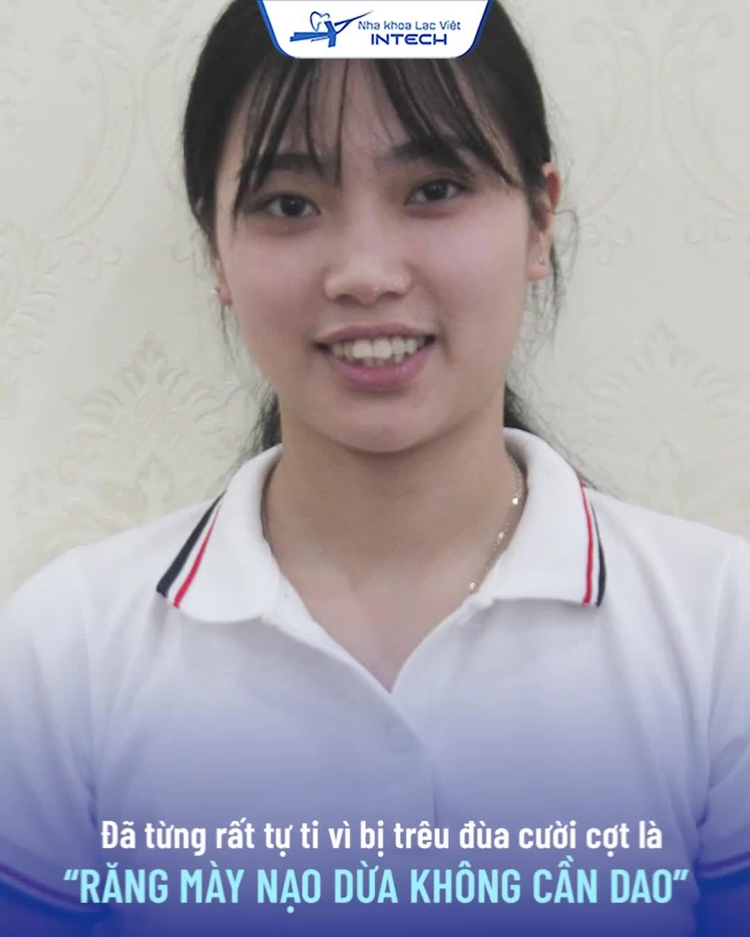 HÀM RĂNG NẠO DỪA VÀ HÀNH TRÌNH 30 THÁNG THAY ĐỔI DIỆN MẠO