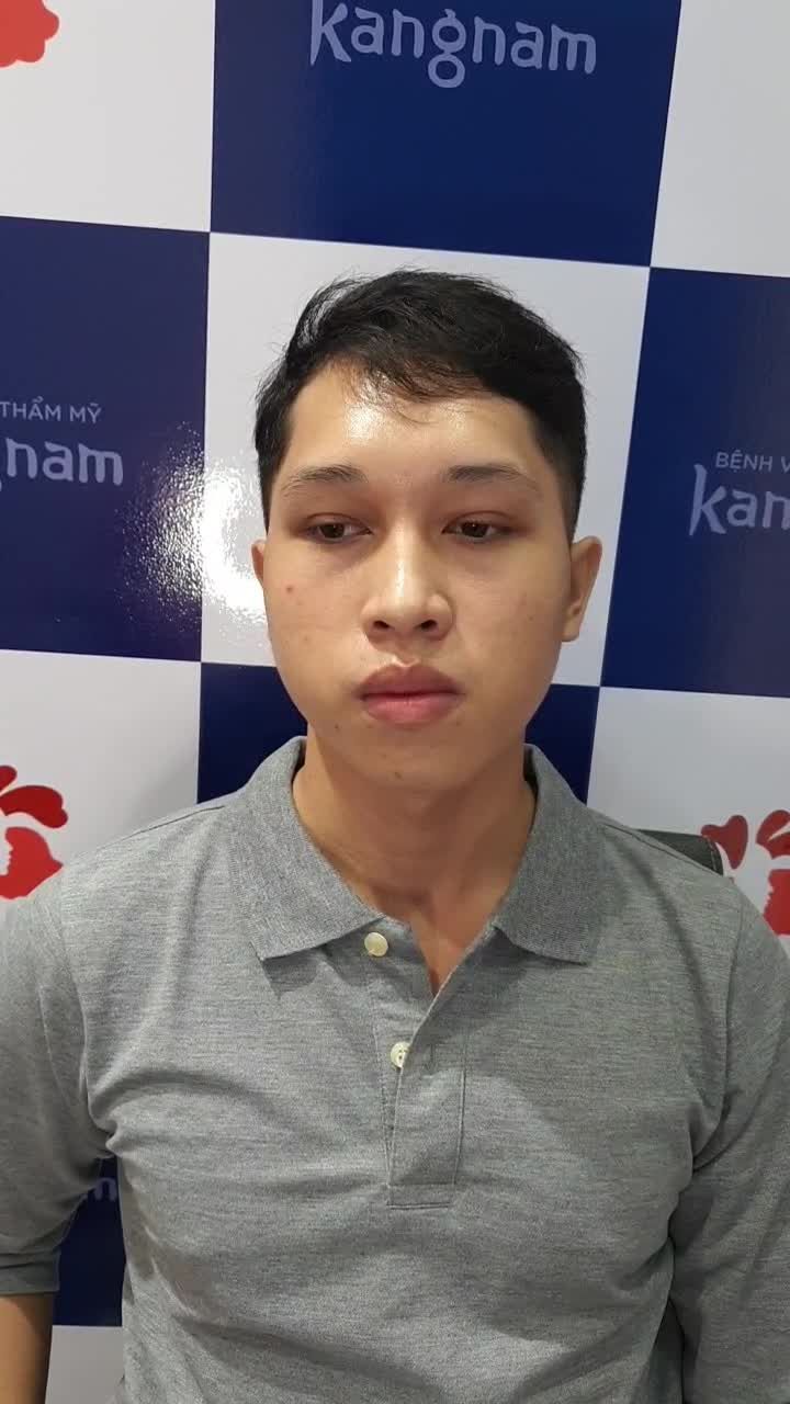 Cắt mí như không cắt - Các anh trai ngại gì chưa đi làm đẹp