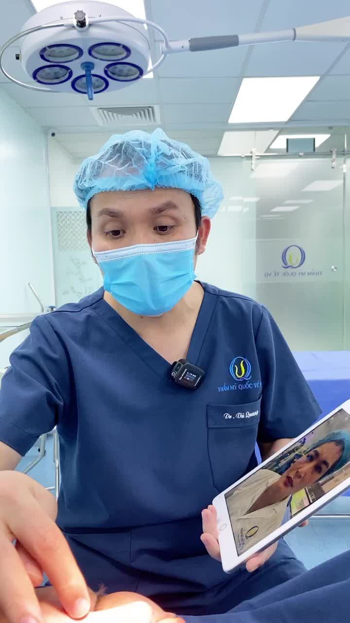 Kết quả combo Nâng mũi cấu trúc Softline + Treo cung mày