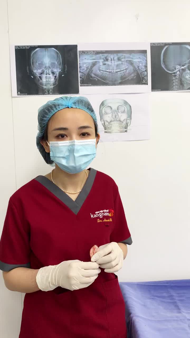 Cùng gặp gỡ bác sĩ Annie Lê chia sẻ về ca phẫu thuật hàm mặt gọt hàm + thay chất liệu độn cằm