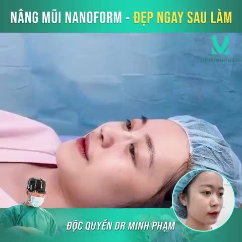 DÁNG MŨI ĐỈNH CỦA CHÓP ĐÂY CẢ NHÀ!!!