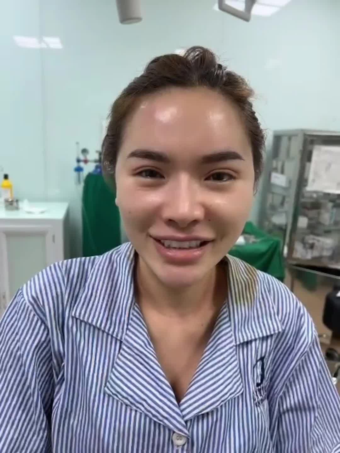 ĐỘN THÁI DƯƠNG sụn Mỹ