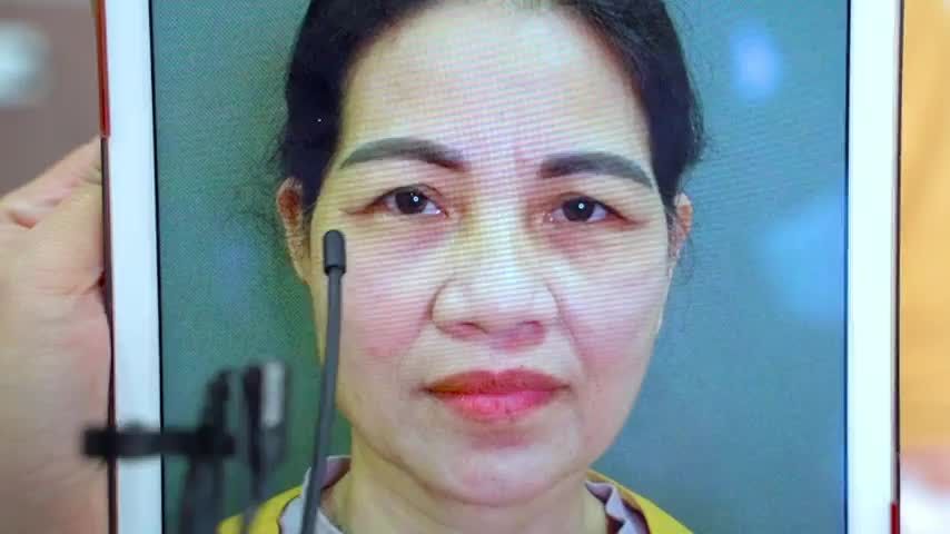 Dr.Hải Lê số 1 thẩm mỹ mắt có thể giúp khách hàng sụp mí tuổi trung niên trẻ hóa đôi mắt đẹp như thế nào Theo dõi ngay
