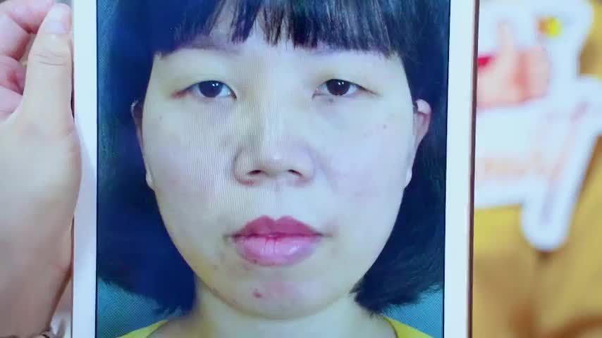 Combo trẻ hóa mí mắt toàn diện giúp khách hàng trẻ ra từ 5 - 10 tuổi bạn có tin Theo dõi ngay