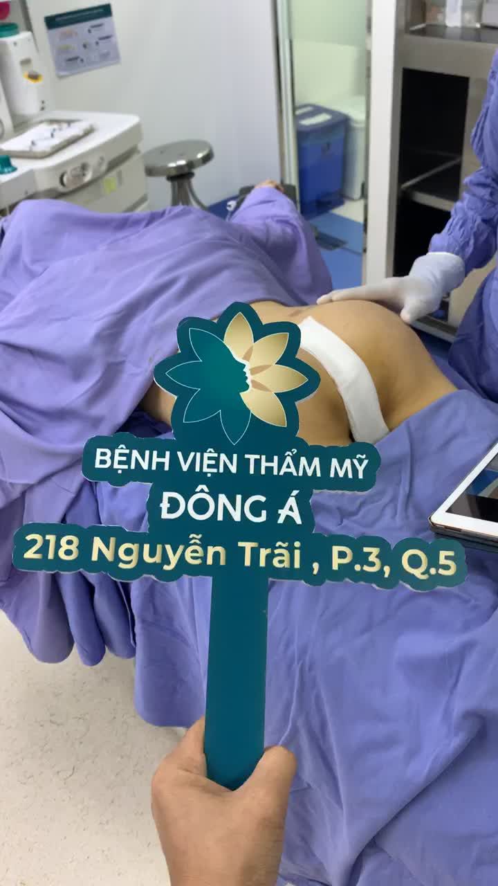 kết quả nâng mông bằng túi nano kết hợp cấy mỡ mông tại bênh viện thẩm mỹ Đông Á