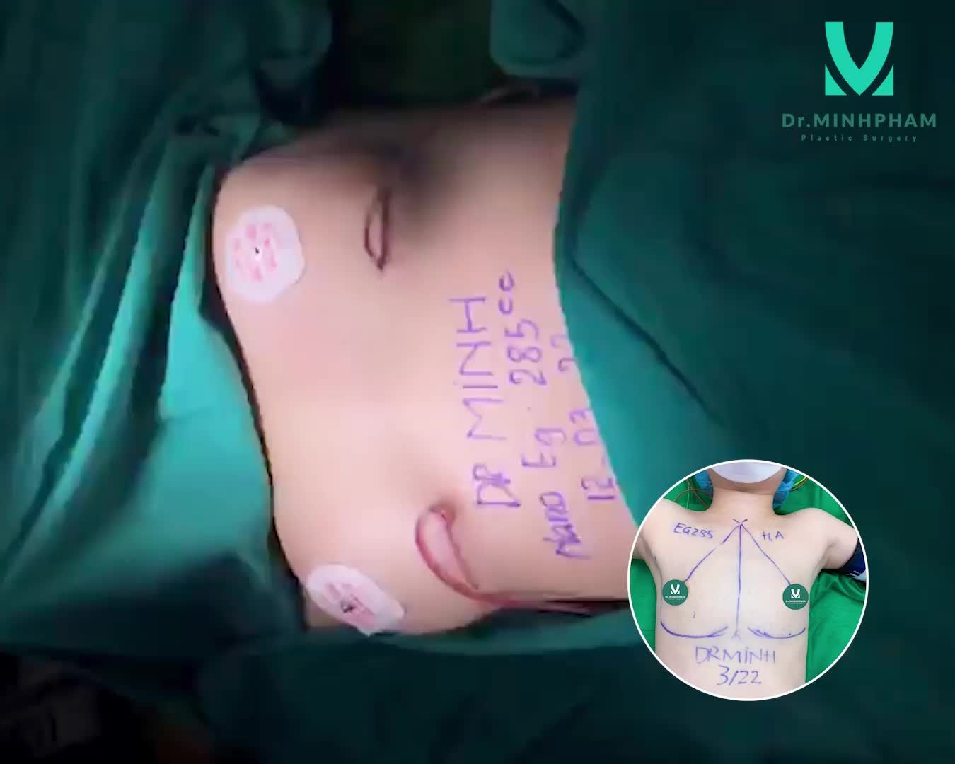 Lột xác thành người khác là có thật luôn ạ.